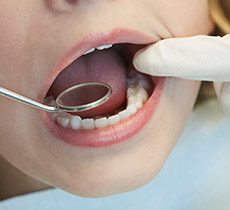 Closeup of child's smile during dental exam